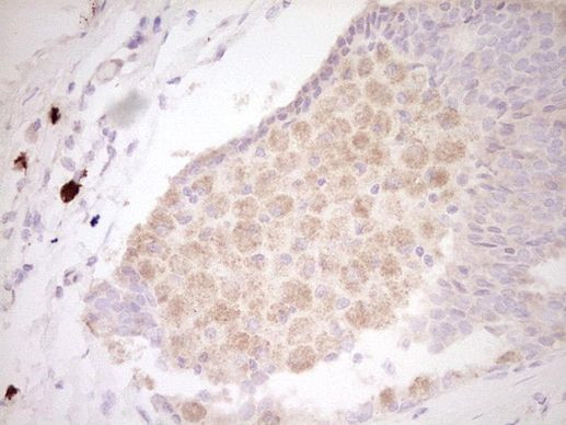 CLOCK Antibody in Immunohistochemistry (Paraffin) (IHC (P))