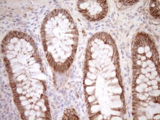 Calpain 5 Antibody in Immunohistochemistry (Paraffin) (IHC (P))