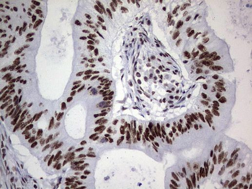 PPP1R8 Antibody in Immunohistochemistry (Paraffin) (IHC (P))