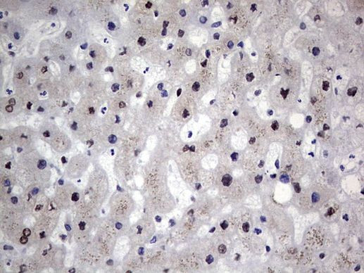 RAD23B Antibody in Immunohistochemistry (Paraffin) (IHC (P))