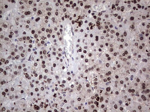 RAD23B Antibody in Immunohistochemistry (Paraffin) (IHC (P))