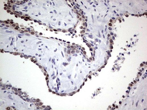 RAD23B Antibody in Immunohistochemistry (Paraffin) (IHC (P))