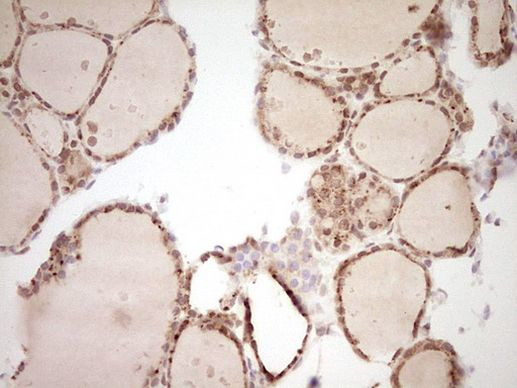 NOR-1 Antibody in Immunohistochemistry (Paraffin) (IHC (P))