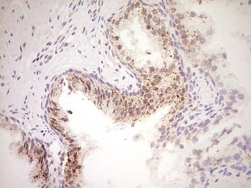 NOR-1 Antibody in Immunohistochemistry (Paraffin) (IHC (P))