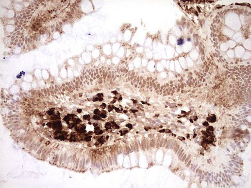 NOR-1 Antibody in Immunohistochemistry (Paraffin) (IHC (P))