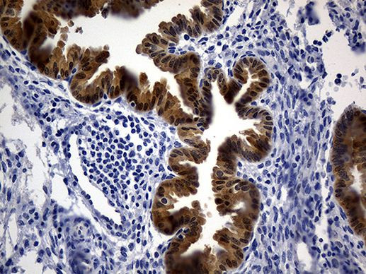 ASL Antibody in Immunohistochemistry (Paraffin) (IHC (P))