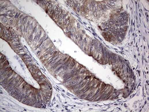 HIP55 Antibody in Immunohistochemistry (Paraffin) (IHC (P))