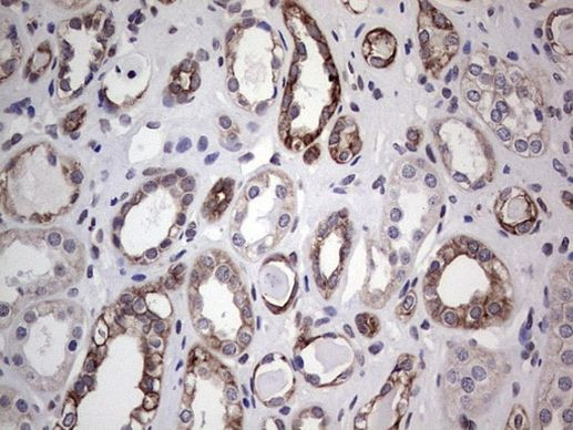 HIP55 Antibody in Immunohistochemistry (Paraffin) (IHC (P))