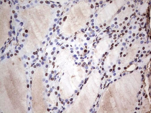 SAE1 Antibody in Immunohistochemistry (Paraffin) (IHC (P))