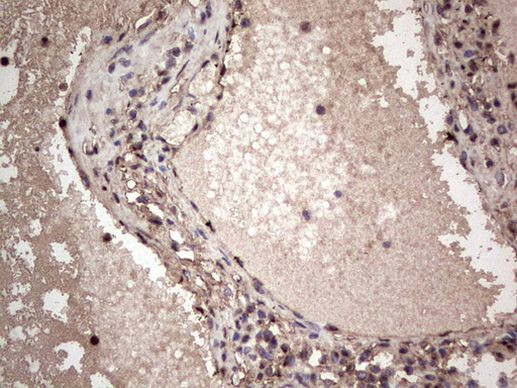 SAE1 Antibody in Immunohistochemistry (Paraffin) (IHC (P))