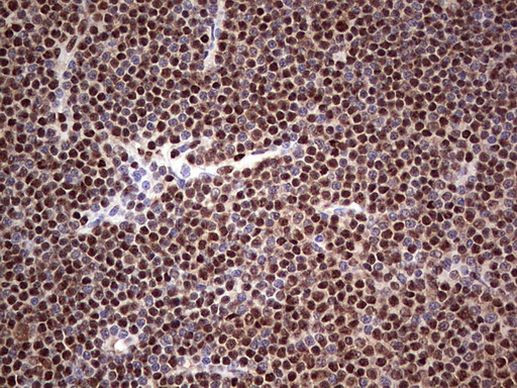 SAE1 Antibody in Immunohistochemistry (Paraffin) (IHC (P))