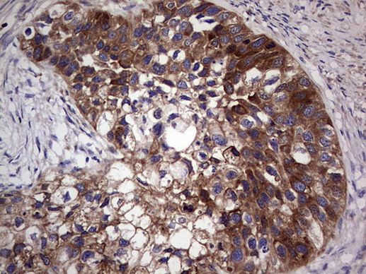 GARS Antibody in Immunohistochemistry (Paraffin) (IHC (P))