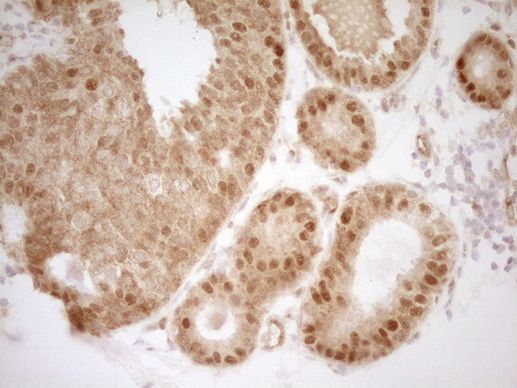 MKL1 Antibody in Immunohistochemistry (Paraffin) (IHC (P))