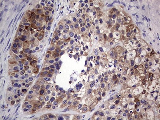 TFPI2 Antibody in Immunohistochemistry (Paraffin) (IHC (P))