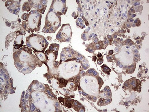 TFPI2 Antibody in Immunohistochemistry (Paraffin) (IHC (P))