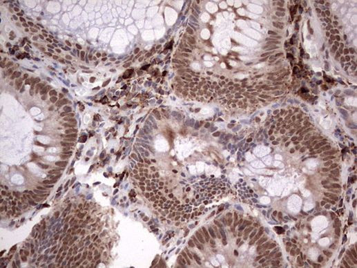 TFPI2 Antibody in Immunohistochemistry (Paraffin) (IHC (P))