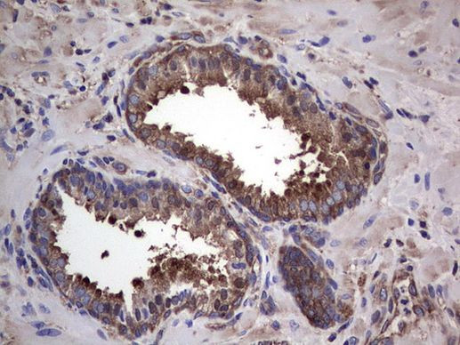 GARS Antibody in Immunohistochemistry (Paraffin) (IHC (P))