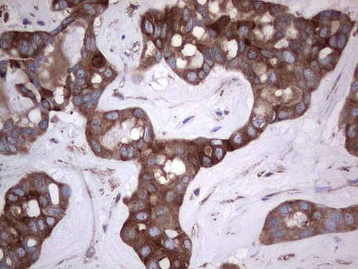 GARS Antibody in Immunohistochemistry (Paraffin) (IHC (P))