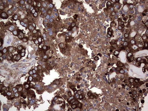 GARS Antibody in Immunohistochemistry (Paraffin) (IHC (P))