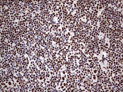 SAE1 Antibody in Immunohistochemistry (Paraffin) (IHC (P))