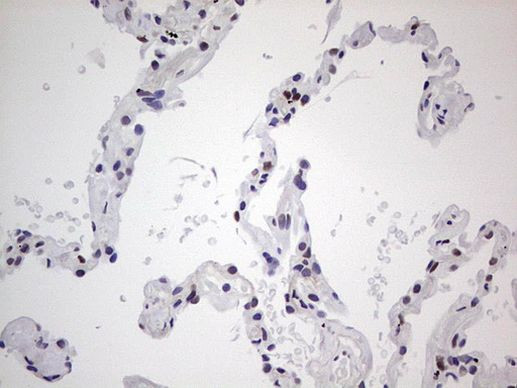 SAE1 Antibody in Immunohistochemistry (Paraffin) (IHC (P))