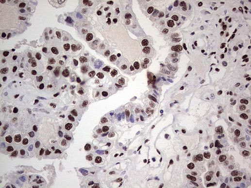 SAE1 Antibody in Immunohistochemistry (Paraffin) (IHC (P))