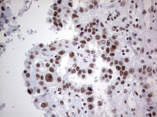 HDAC9 Antibody in Immunohistochemistry (Paraffin) (IHC (P))