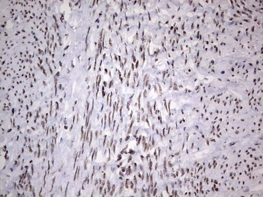 HDAC9 Antibody in Immunohistochemistry (Paraffin) (IHC (P))