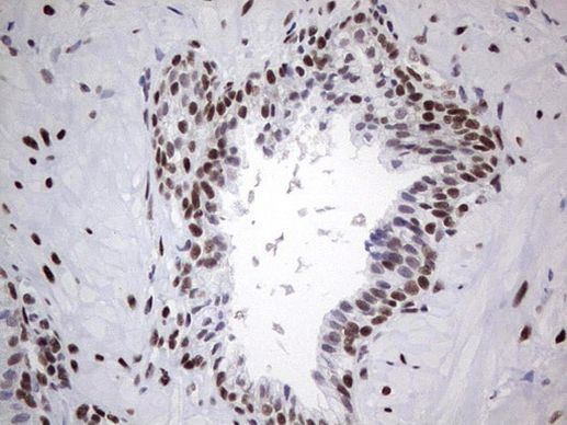 HDAC9 Antibody in Immunohistochemistry (Paraffin) (IHC (P))