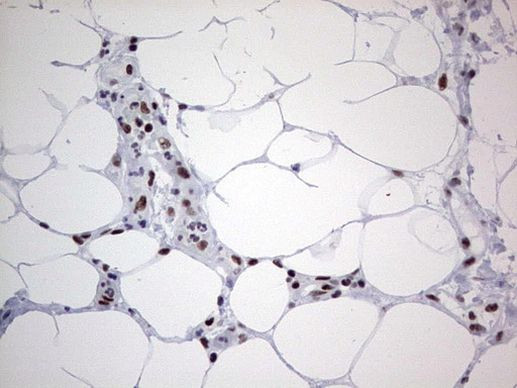 HDAC9 Antibody in Immunohistochemistry (Paraffin) (IHC (P))