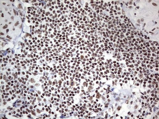 HDAC9 Antibody in Immunohistochemistry (Paraffin) (IHC (P))