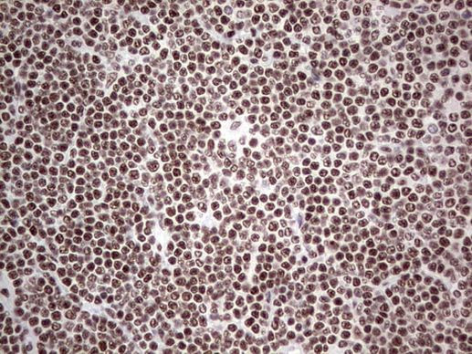 HDAC9 Antibody in Immunohistochemistry (Paraffin) (IHC (P))