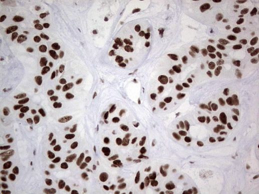 HDAC9 Antibody in Immunohistochemistry (Paraffin) (IHC (P))