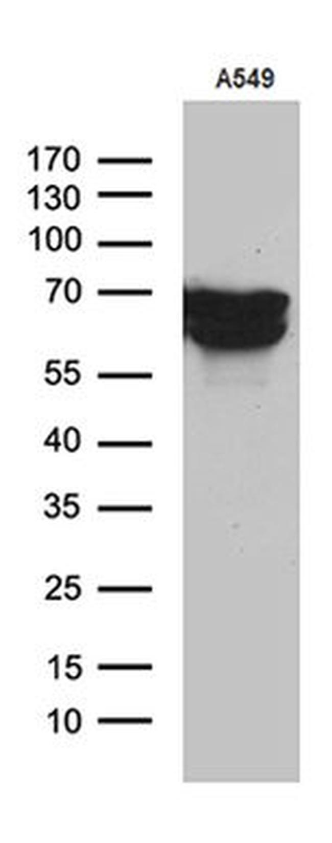 TGFBI Antibody in Western Blot (WB)