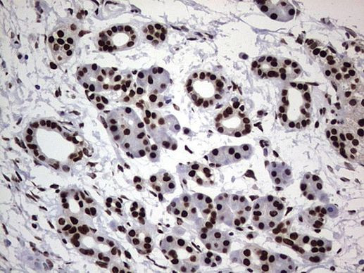 hnRNP L Antibody in Immunohistochemistry (Paraffin) (IHC (P))