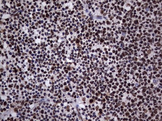 hnRNP L Antibody in Immunohistochemistry (Paraffin) (IHC (P))