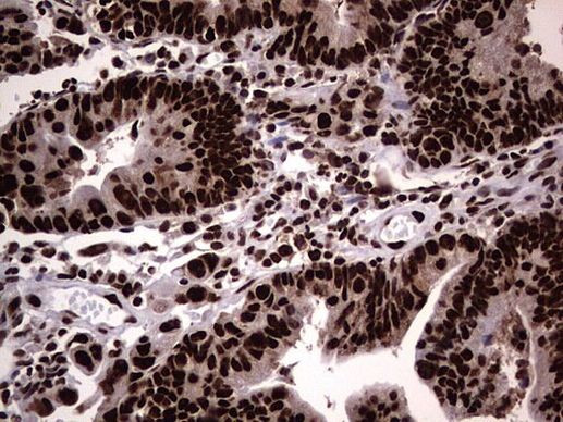 hnRNP L Antibody in Immunohistochemistry (Paraffin) (IHC (P))