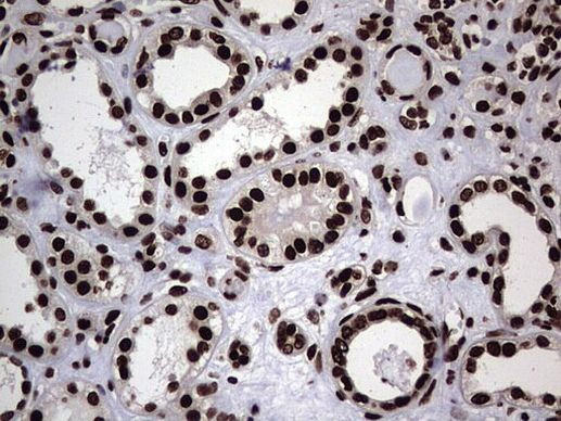 hnRNP L Antibody in Immunohistochemistry (Paraffin) (IHC (P))