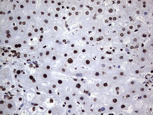 hnRNP L Antibody in Immunohistochemistry (Paraffin) (IHC (P))