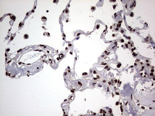 hnRNP L Antibody in Immunohistochemistry (Paraffin) (IHC (P))