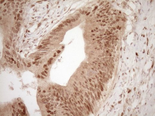 GFI1 Antibody in Immunohistochemistry (Paraffin) (IHC (P))