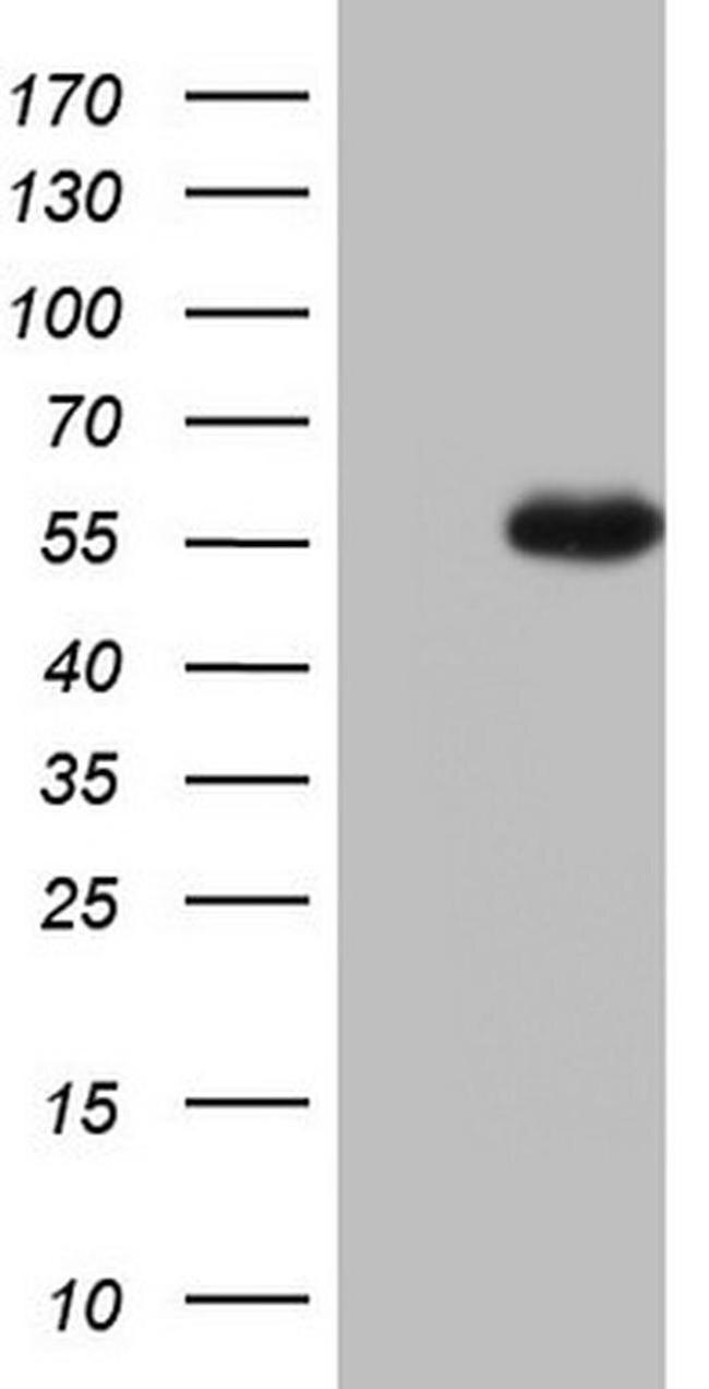 NUDT12 Antibody in Western Blot (WB)