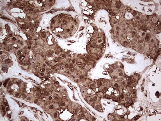 NUDT12 Antibody in Immunohistochemistry (Paraffin) (IHC (P))