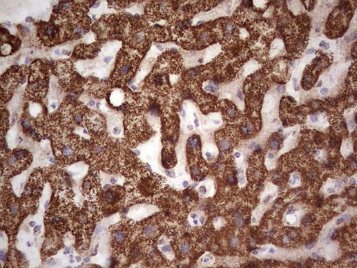 CANT1 Antibody in Immunohistochemistry (Paraffin) (IHC (P))