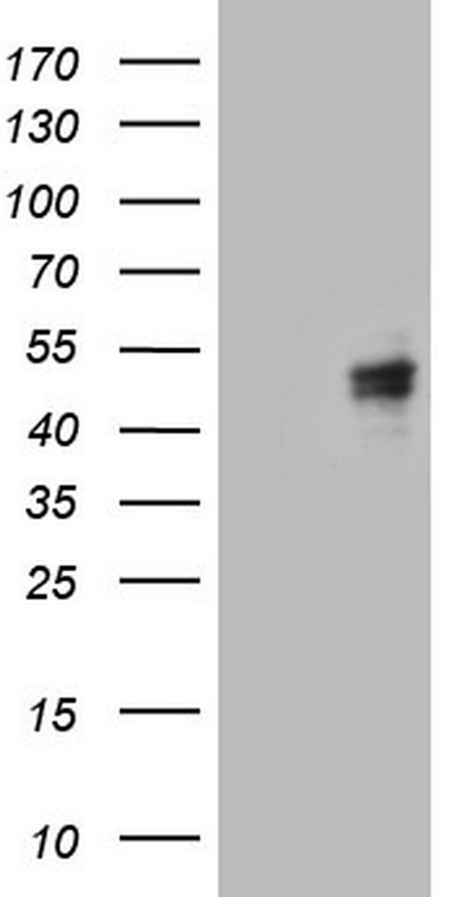 CANT1 Antibody in Western Blot (WB)