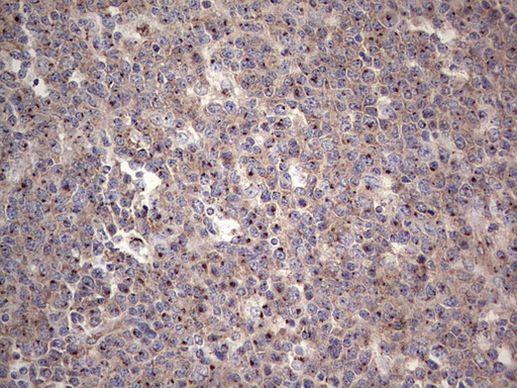 ABH1 Antibody in Immunohistochemistry (Paraffin) (IHC (P))