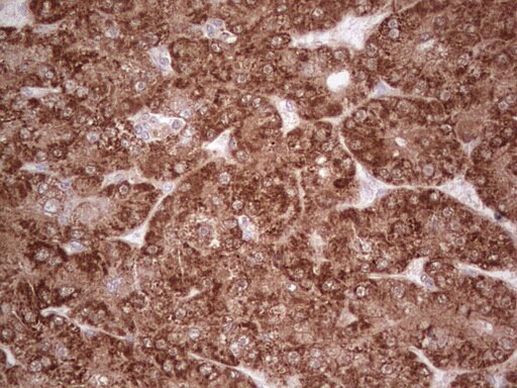 MARK3 Antibody in Immunohistochemistry (Paraffin) (IHC (P))