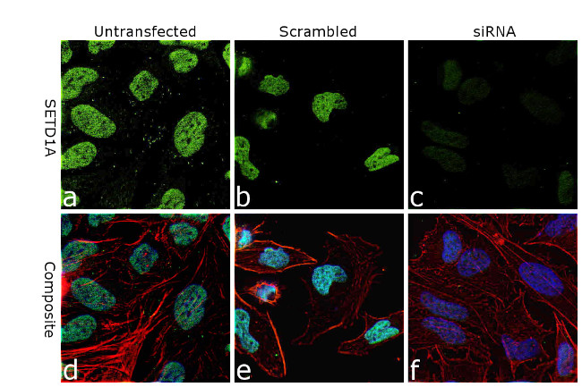 SETD1A Antibody in Immunocytochemistry (ICC/IF)