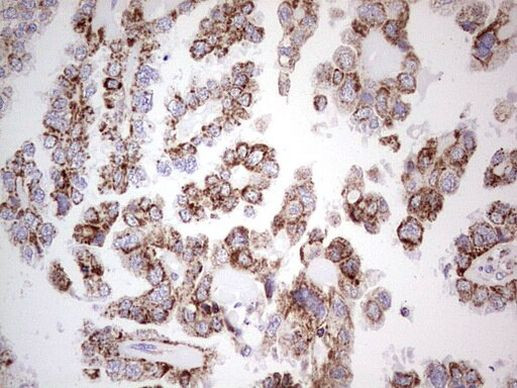 LRRC6 Antibody in Immunohistochemistry (Paraffin) (IHC (P))