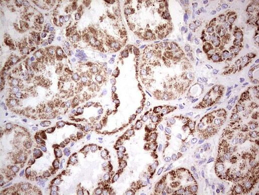 LRRC6 Antibody in Immunohistochemistry (Paraffin) (IHC (P))